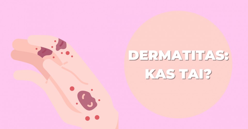 Dermatitas: kas tai bei kaip palengvinti jo požymius?