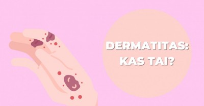 Dermatitas: kas tai bei kaip palengvinti jo požymius?